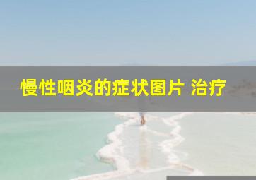 慢性咽炎的症状图片 治疗